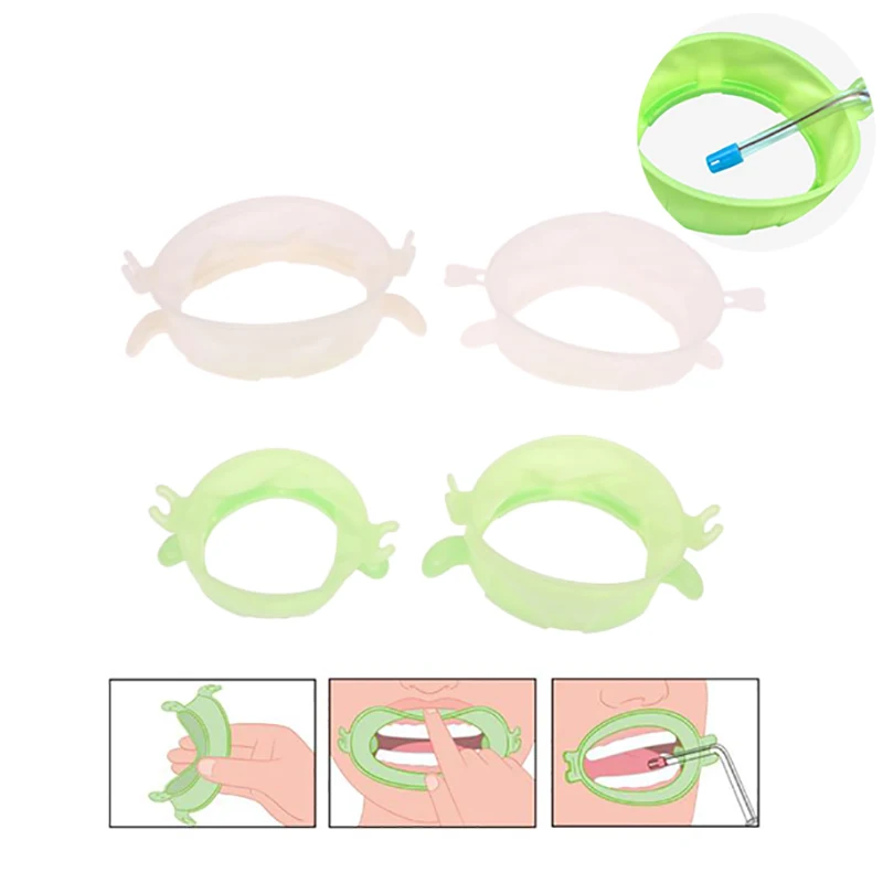 3Pcs S/M/L Dental Lip Cheek Re - Teeth Whitening Accelerator review and price
