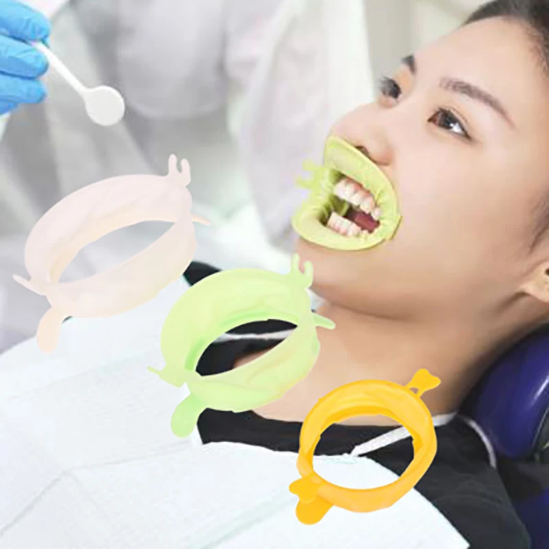 3Pcs S/M/L Dental Lip Cheek Re - Teeth Whitening Accelerator review and price