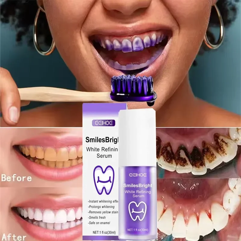 Teeth Cleansing Whitening Toot - Teeth Whitening Korea review and price