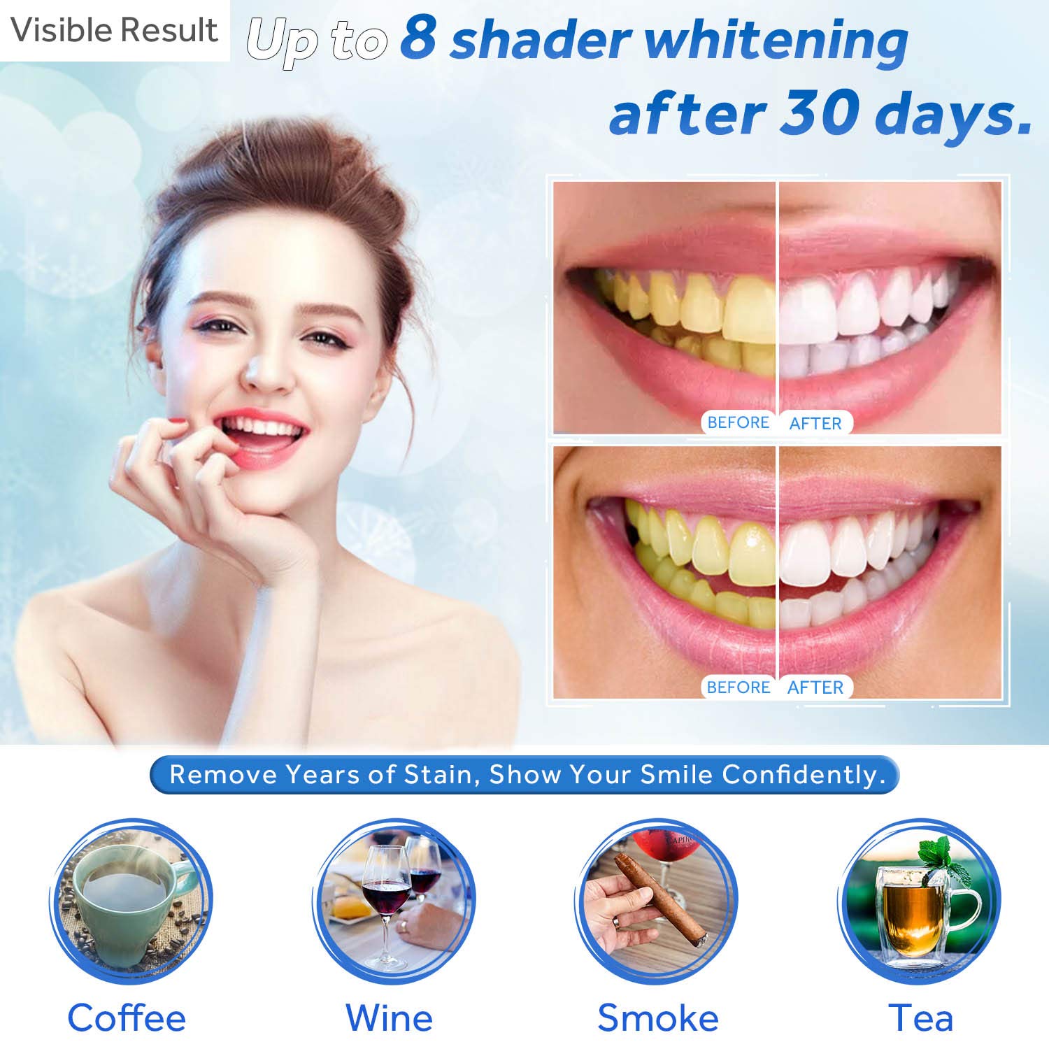 Teeth Whitening Gel Refill Syr - Teeth Whitening Accelerator review and price