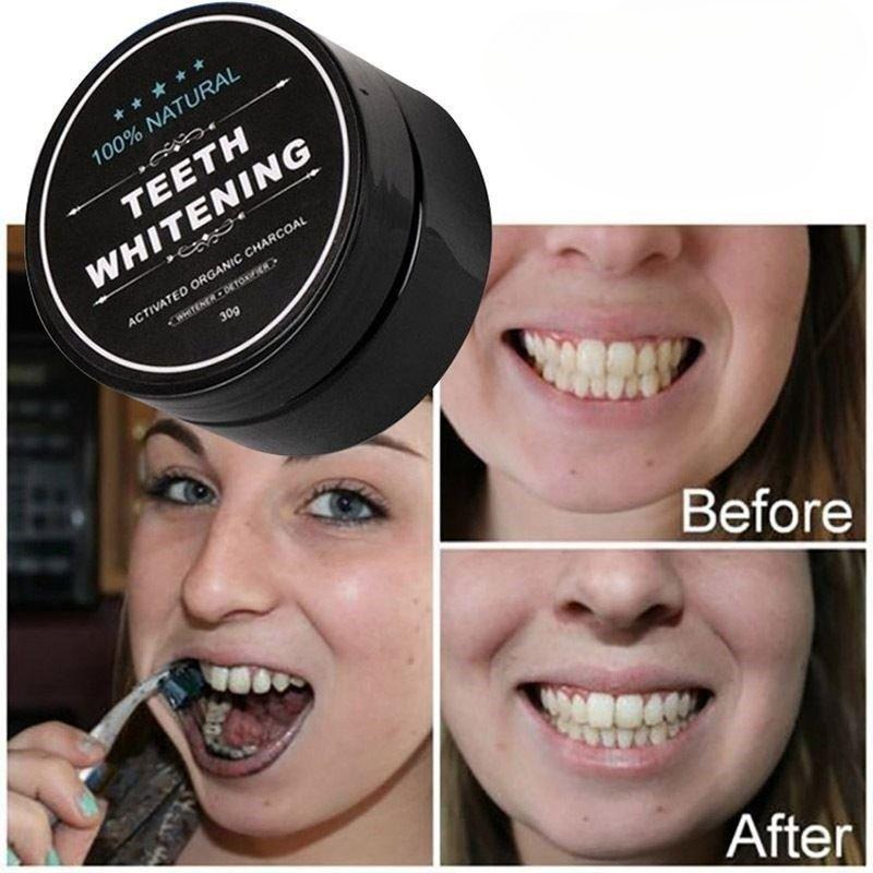 1 Box Activated Charcoal Teeth - Teeth Whitening Street review and price