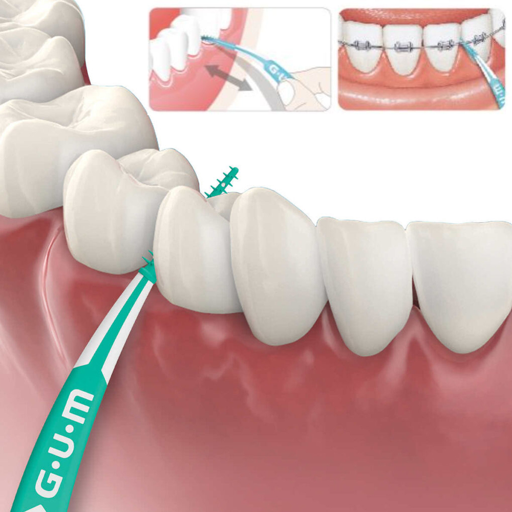 Gum Soft Picks Advanced Small  - Teeth Whitening In Japan review and price